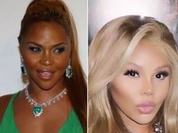 Lil Kim before and after skin whitening surgery